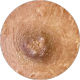 Icone Areolas